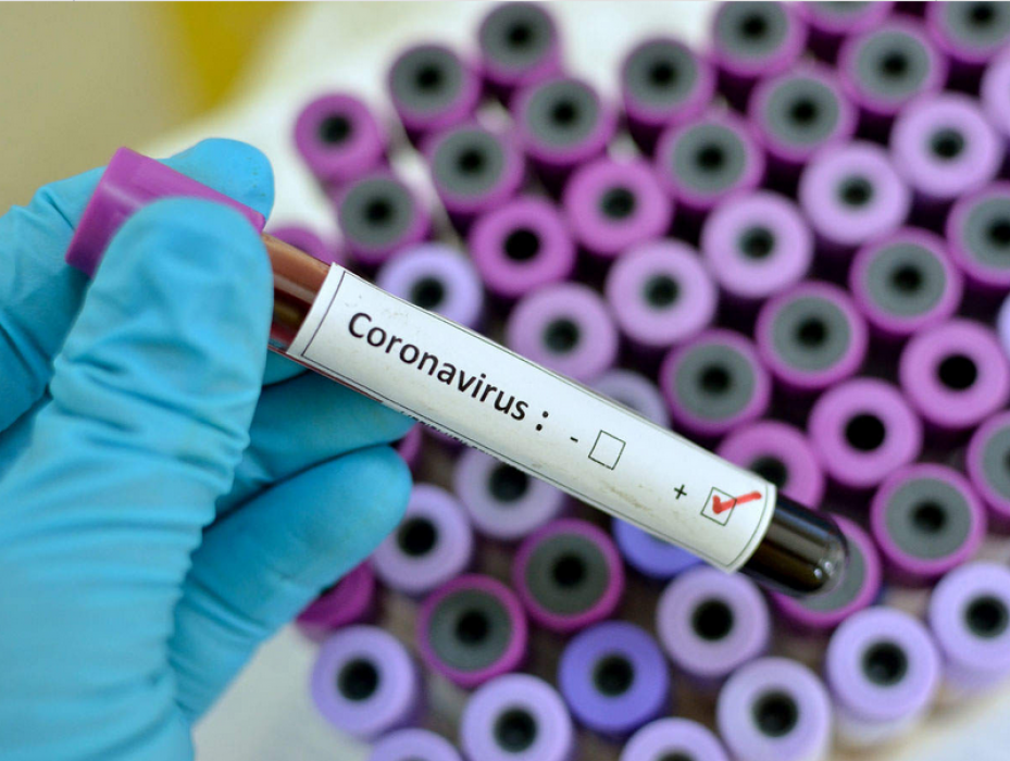 1-24-20-coronavirus