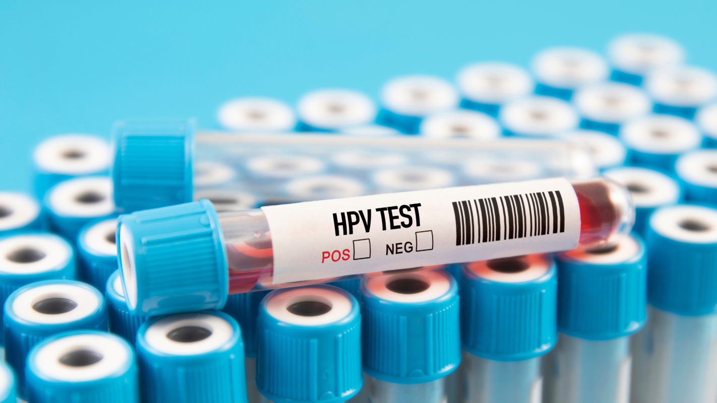 hpv test